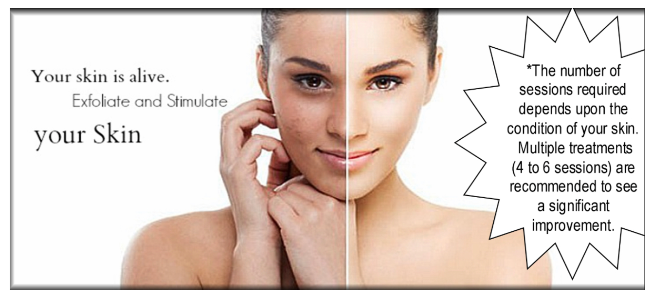 Crystal Microdermabrasion - 1 hr.