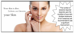 Crystal Microdermabrasion 75 min